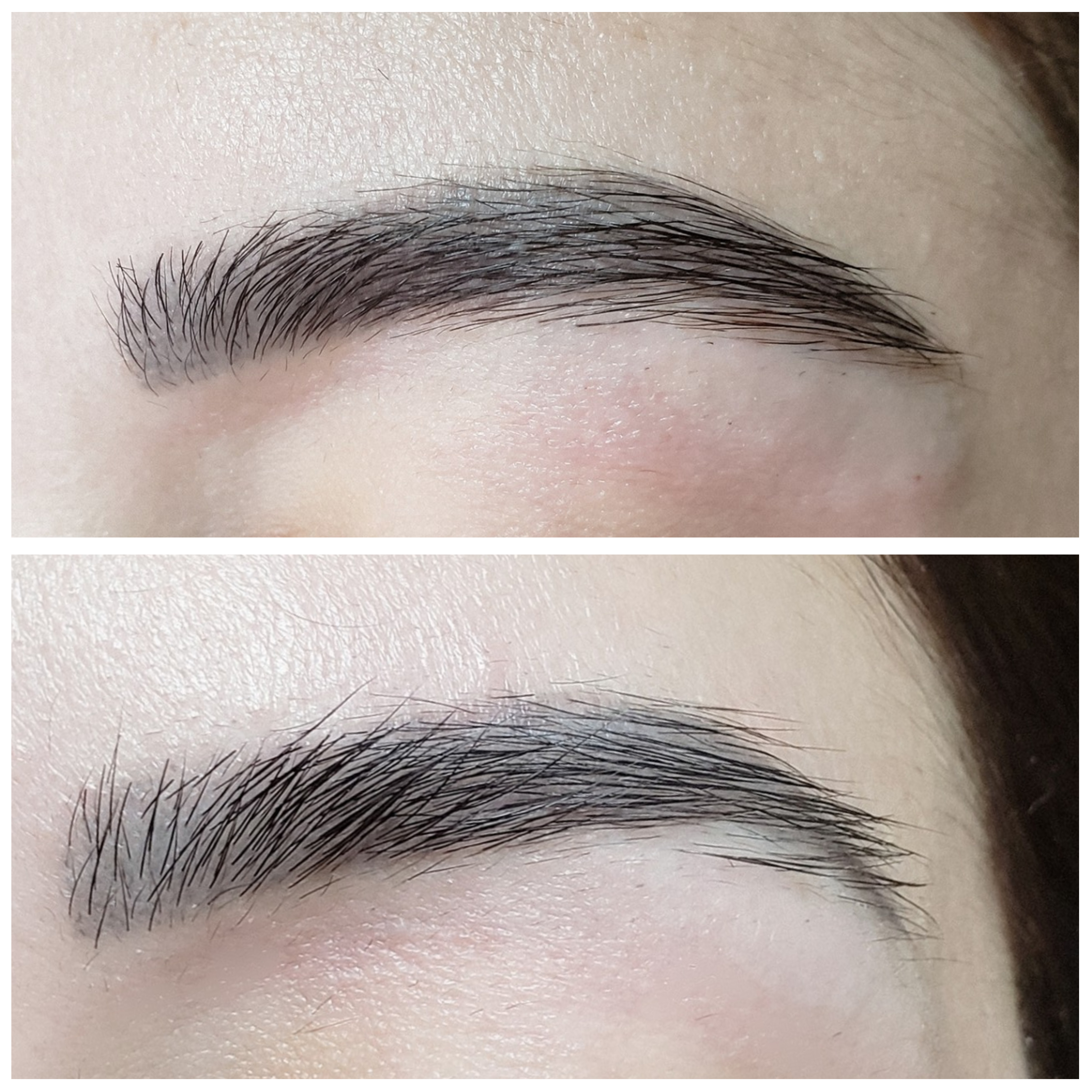Antes e Depois — Reconstrução