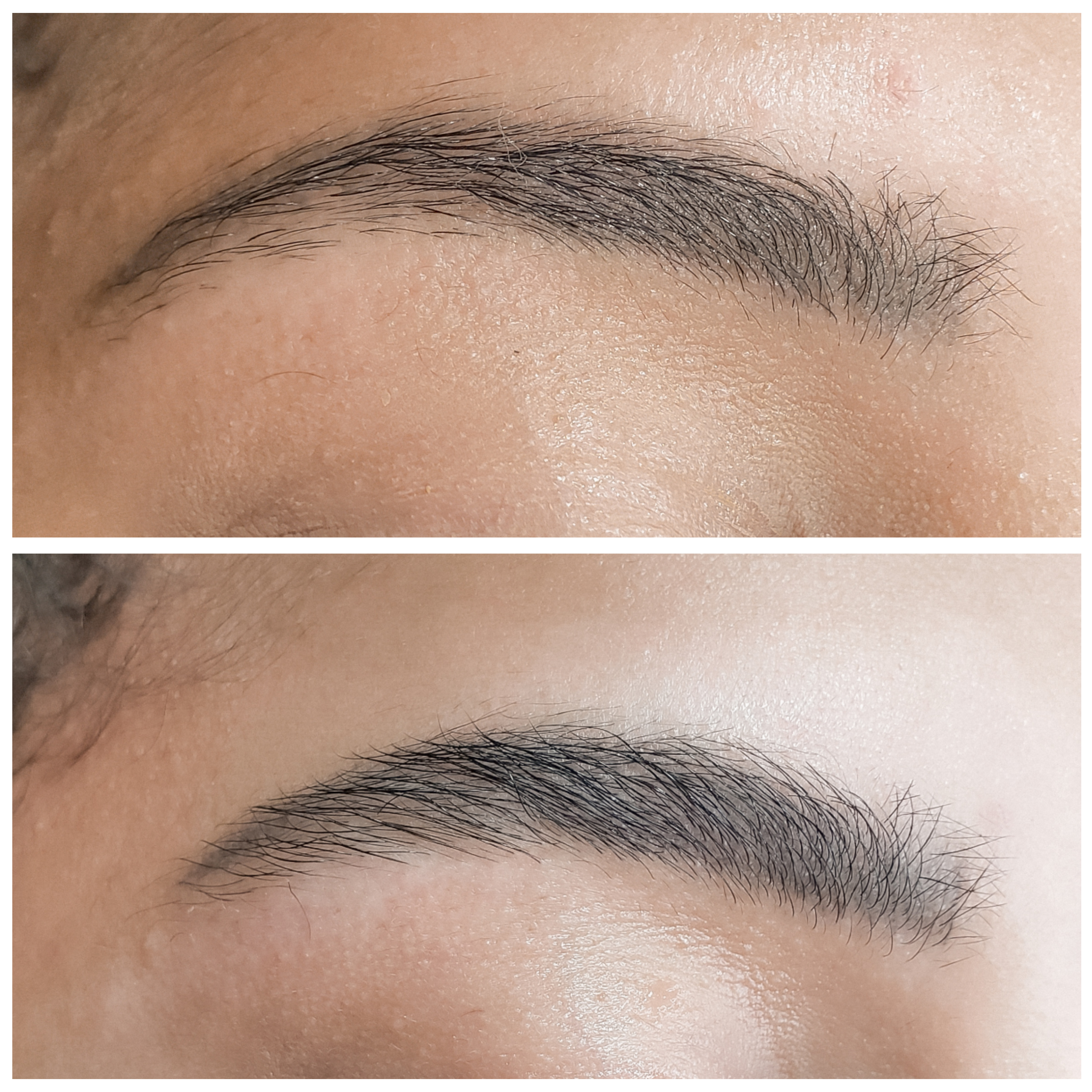 Antes e Depois — Reconstrução