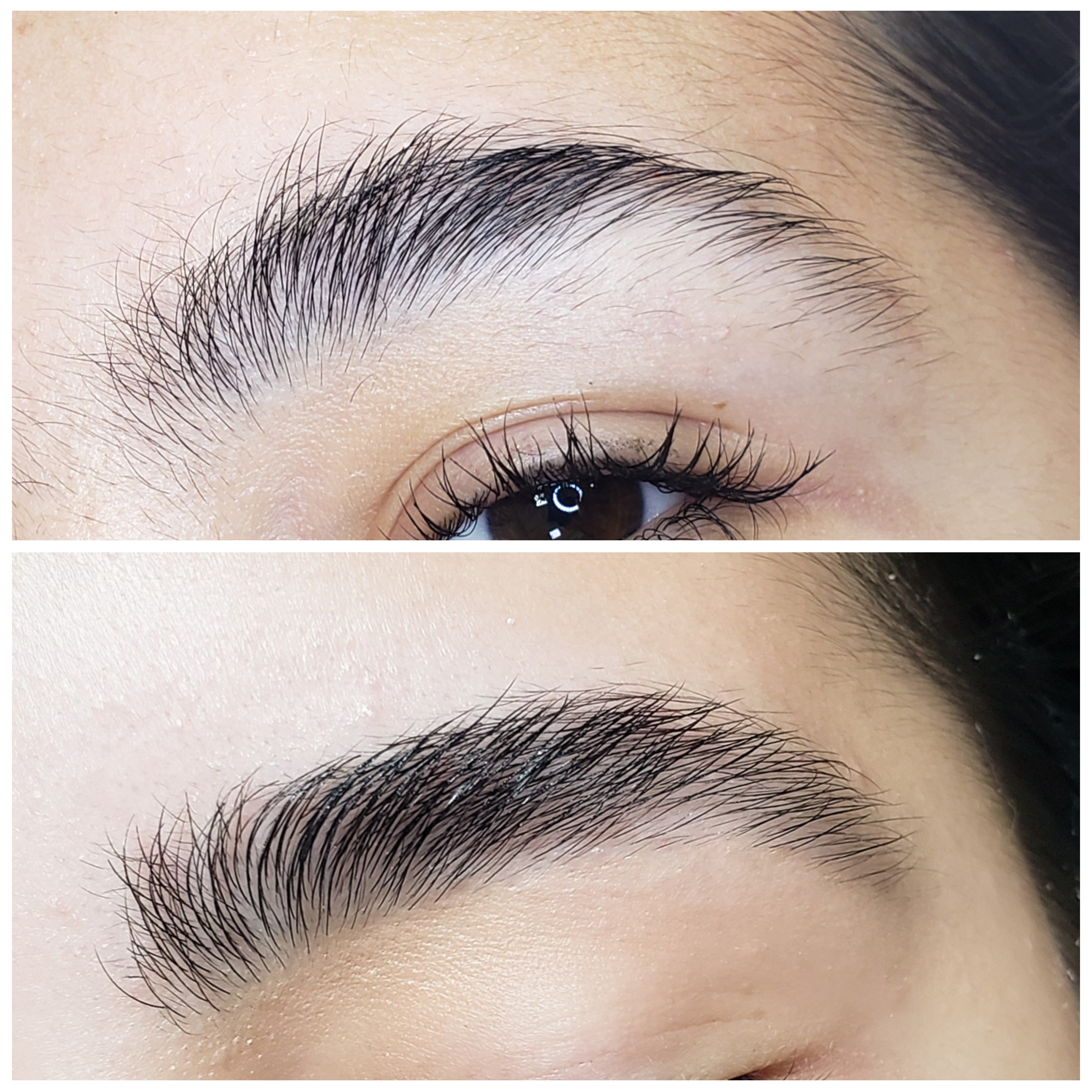 Antes e Depois — Reconstrução